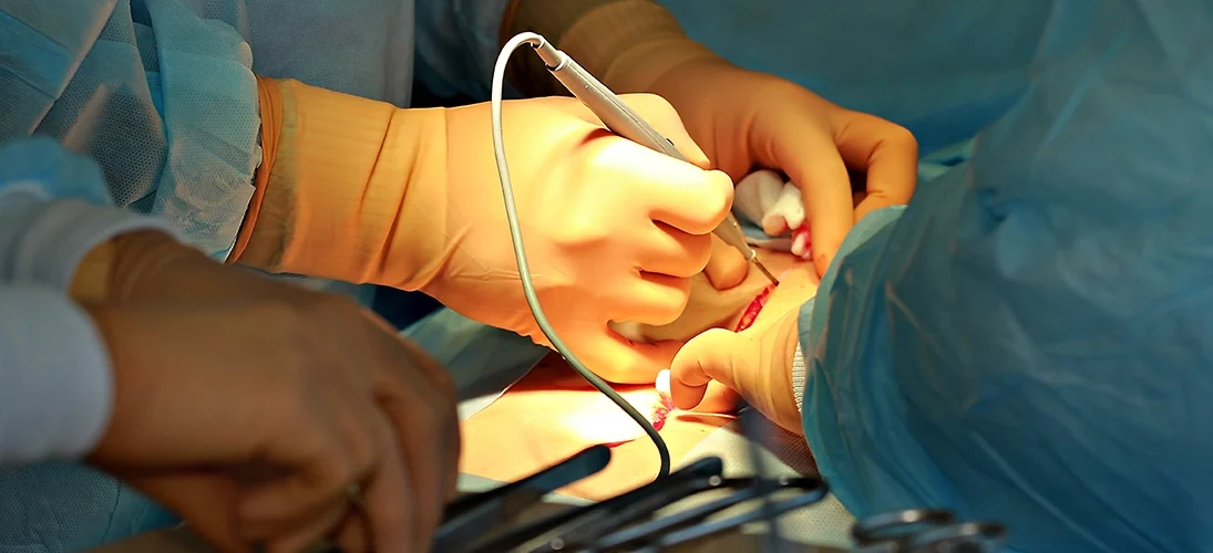 Chirurgie de l’obésité : l’opération miracle ?  