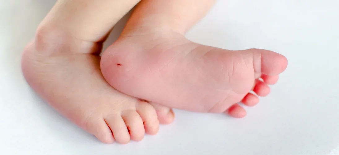 Dépistage néonatal : mode d’emploi