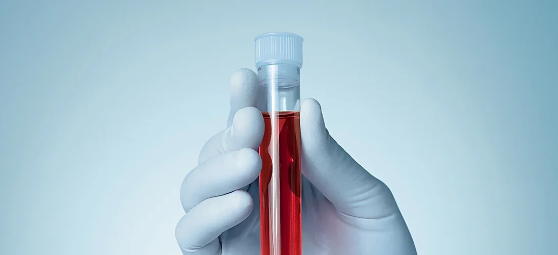 Le sang, reflet de notre santé